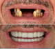 Slider image (10) Dis 212 - Dental Aesthetics Facility